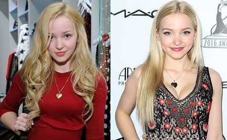 A before and after picture of Dove Cameron.
